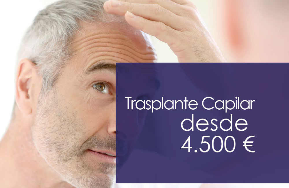 Trasplante Capilar Clínicas Mato Ansorena