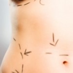 vogue-marzo-2012-2-aumento-de-pecho-senos-mamas-mamoplasia-abdominoplastia-madrid-sevilla-huelva