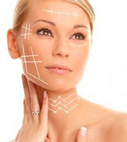 Hilos Mágicos - Hilos Tensores - Cara, Facial, Cuello - Madrid, Sevilla, Huelva
