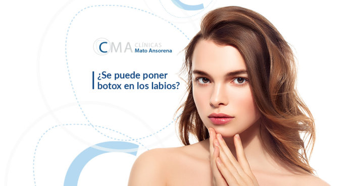 BLOG-BOTOX-LABIOS-MATOANSORENA bótox en los labios