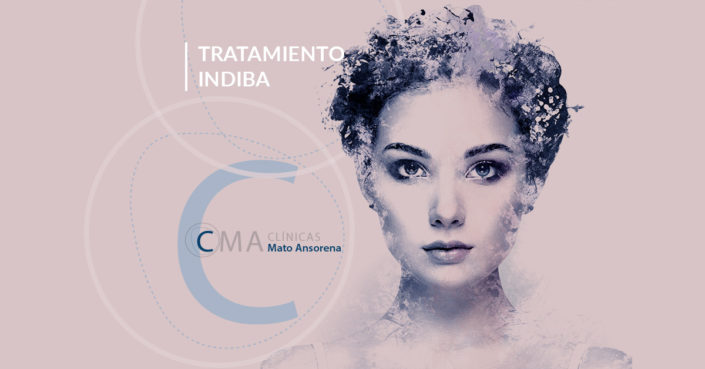 BLOG-INDIBA-MATO-ANSORENA Indiba