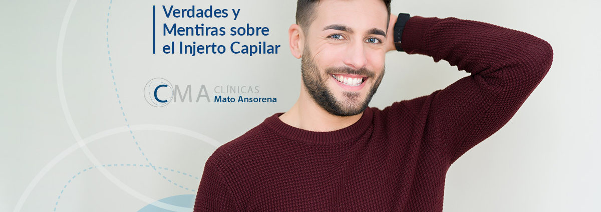 Verdades y mentiras sobre el injerto capilar