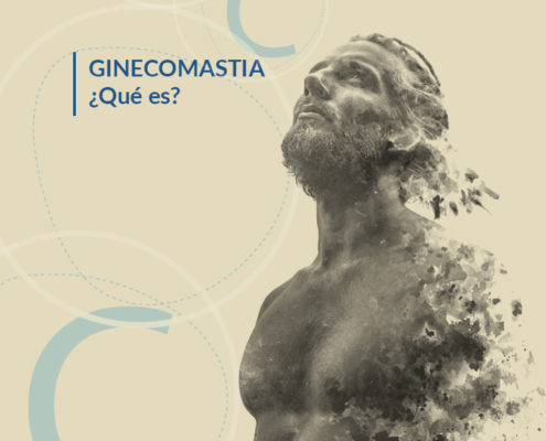 ginecomastia