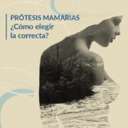 Prótesis mamarias: ¿Cómo elegir las mejores?