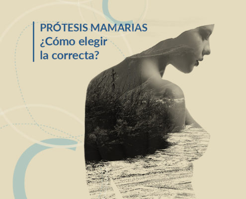 Prótesis mamarias: ¿Cómo elegir las mejores?