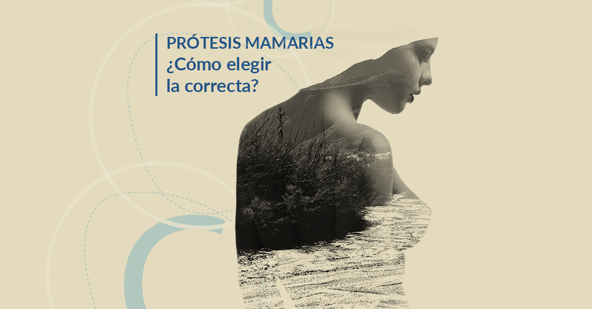 Prótesis mamarias: ¿Cómo elegir las mejores?