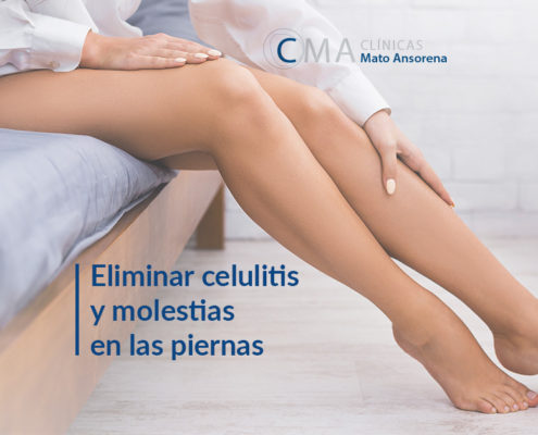 cuidado de piernas