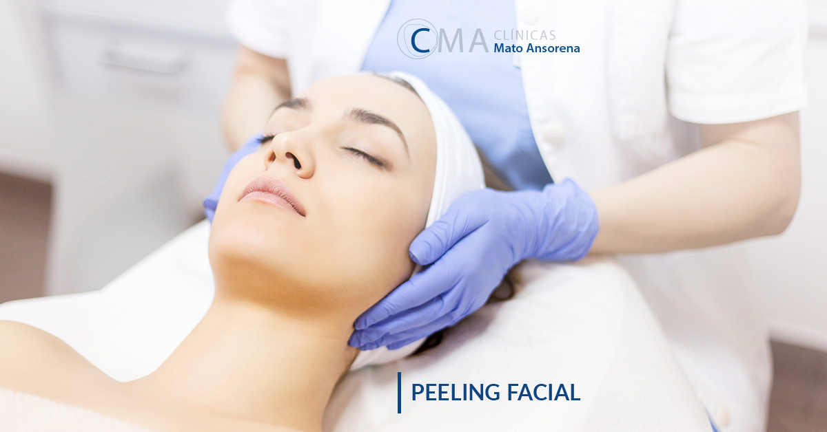 peeling facial