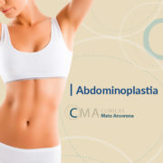 abdominoplastia