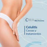 celulitis