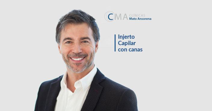 BLOG-injerto-capilar-canas injerto capilar con canas