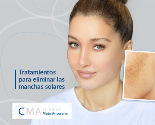 Desde el mes pasado estamos recibiendo a muchos pacientes que solicitan asesoramiento sobre los diferentes métodos para eliminar las manchas faciales. Este año, al estar nuestra piel más sensible por la falta de luz que padecimos durante el confinamiento, nuestro cutis ha experimentado un aumento de léntigos solares. A continuación, os contamos cuáles son los tratamientos para eliminar las manchas solares.   ¿Qué son las manchas solares? Las manchas en la piel son el resultado de la diferente distribución de la melanina y las células que la producen, los melanocitos. La melanina es el pigmento que nos protege frente a los rayos solares, por tanto, al exponernos al sol los melanocitos segregan más melanina. Existen diferentes tipos de manchas que nos podemos encontrar en la piel: -Léntigos (los más comunes): son hiperpigmentaciones concretas y bien delimitadas en zonas expuestas prolongadamente al sol como la cara, la espalda, el escote y las manos. -Las efélides (o pecas): pequeñas manchas sin relieve de color café claro o rojizas, localizadas frecuentemente en zonas fotoexpuestas como cara, cuello y brazos en personas de piel blanca, en jóvenes y que se intensifican con la exposición solar. Pueden convertirse más adelante en léntigos. -Nevus o lunares: acumulaciones de mayor número de melanocitos afectando a las diferentes estructuras de la piel. Por tanto, tendremos diferentes tipos de lunares en función de sus características. Resulta especialmente importante el control, sobre todo de aquellos lunares con ciertas características como son la asimetría, bordes irregulares, cambios de coloración o coloración no homogénea, diámetro superior a 6 mm y la evolución del mismo. -Melasma: manchas de color marrón claro o intenso mal delimitada o con contornos geográficos que suelen aparecer casi exclusivamente en mujeres y que se producen o agravan en el embarazo (cloasma), la toma de anticonceptivos o la menopausia. -Pigmentación post-inflamatoria: es la respuesta de la piel a una herida o erosión. Por ejemplo, en una paciente morena con acné o tras una quemadura.  Tratamientos para eliminar las manchas solares Cabe destacar que el tratamiento del melasma, al tener una influencia hormonal y una sensibilidad al sol, puede resultar de difícil manejo. Por tanto, el tratamiento tiene que ser continuado y prolongado todo el año. Es posible conseguir una gran mejoría, pero la hiperpigmentación puede volver a reaparecer.  Entre los métodos disponibles para el tratamiento de las manchas encontramos:  -Dermocosméticos médicos: pueden mejorar el aspecto de las manchas y deben individualizarse en función del problema y el tipo de piel. Algunos de estos componentes son la hidroquinona, el retinol, el ácido kójico, el ácido glicólico, el ácido azelaico, la vitamina C, entre otros.   -Peeling despigmentantes: como el Bra peeling, que es un innovador tratamiento de rejuvenecimiento con efecto peeling de ácido tricloroacético (TCA), eficaz, seguro y adaptable. Se puede utilizar la concentración más adecuada dependiendo de la indicación (15% o 30% de TCA). Además, evita la hiperpigmentación postinflamatoria gracias a la combinación de la vitamina C y el ácido fítico. También corrige imperfecciones cutáneas, tales como arrugas, tono apagado no uniforme, textura irregular, cicatrices superﬁciales, discromías, hiperqueratosis o poros dilatados. El protocolo va en función de cada paciente oscilando entre 3 y 5 sesiones espaciadas por 1 mes.   - Mesoterapia revitalizante: incluye ácido hialurónico, 12 vitaminas incluyendo la vitamina C que actúa sobre la síntesis de colágeno en la inhibición de los radicales libres y la hiperproducción localizada de la melanina, 23 aminoácidos, 6 minerales, 6 coenzimas, y 5 ácidos nucleicos. El protocolo son 3 sesiones espaciadas por 15 días + 2 sesiones espaciadas por 1 mes.  Recordad que cualquier tratamiento siempre debe ir acompañado por un control médico y la aplicación de alta protección solar.  Si quieres que nuestro equipo médico te asesore sobre cuáles son los tratamientos para eliminar las manchas solares más adecuados para tu caso, no dudes en pedir cita en una de nuestras clínicas. 