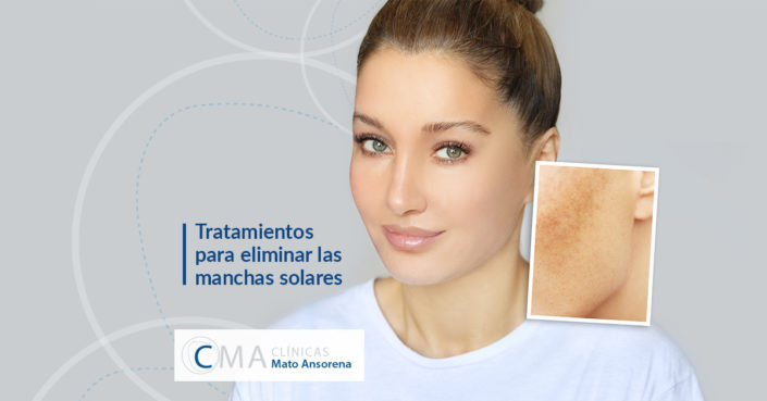 BLOG-manchas-solares-matoansorena Tratamientos para eliminar las manchas solares