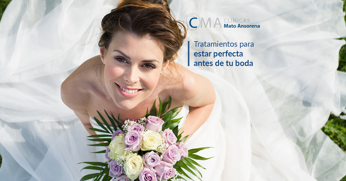 Tratamientos de belleza para novias