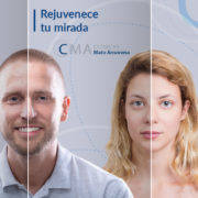 tratamiento para rejuvenecer la mirada