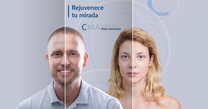 BLOG-rejuvenece-tu-mirada tratamiento para rejuvenecer la mirada