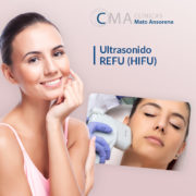 ultrasonido REFU HIFU