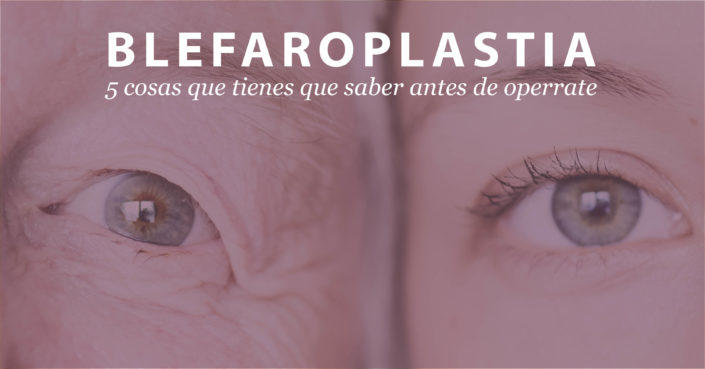 BlefarodefCMAFBii