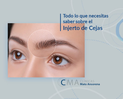 injerto de cejas