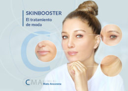 skinboosters. ¿Qué son y para qué sirven?