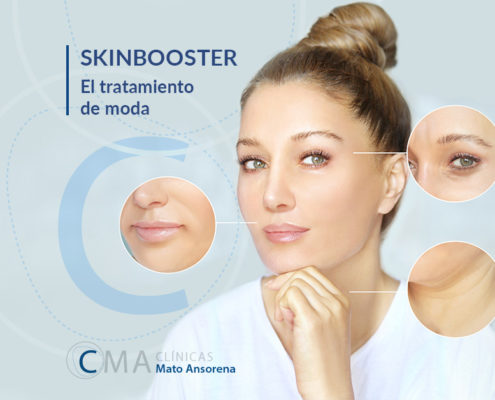 skinboosters. ¿Qué son y para qué sirven?