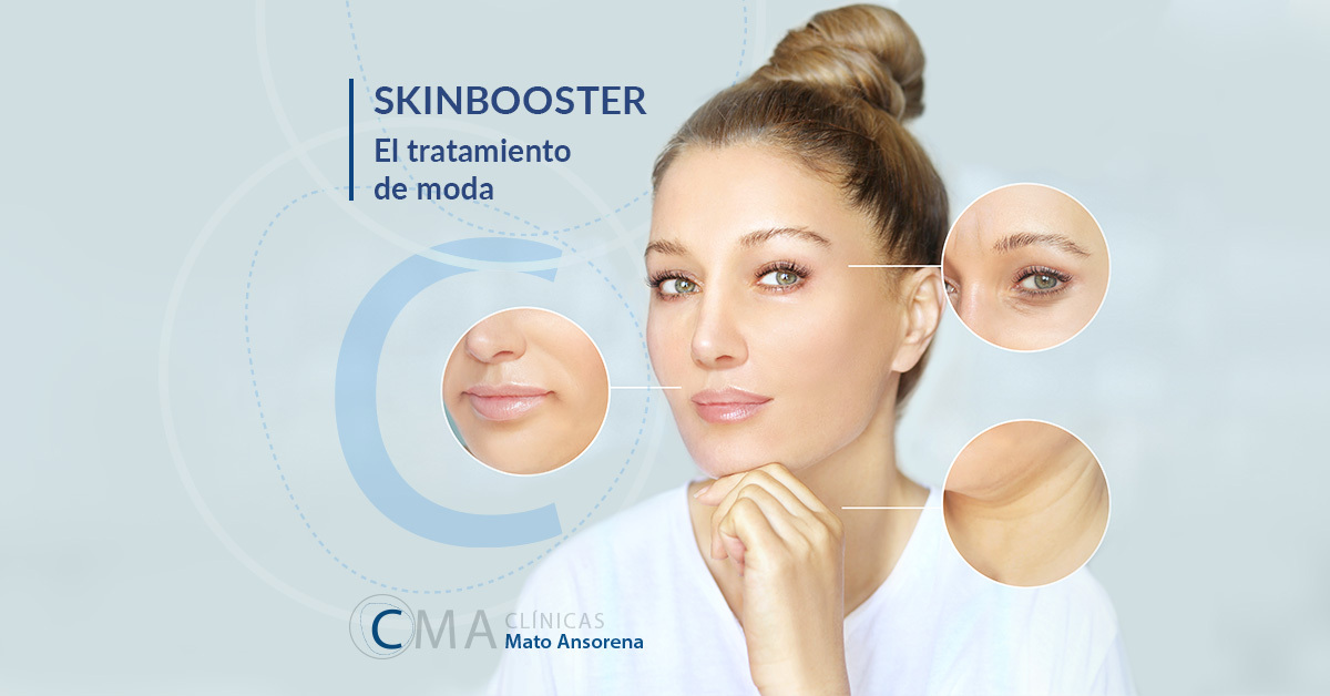 skinboosters. ¿Qué son y para qué sirven?