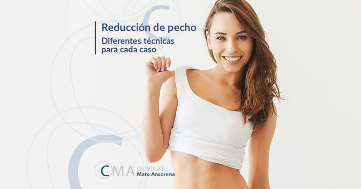 MATOANSORENA-BLOG-REDUCCION-PECHO reducción de pecho