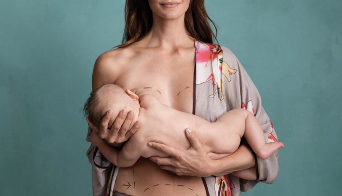 MO-mommy-makeover-breastfeeding-colin-lenton-940×540