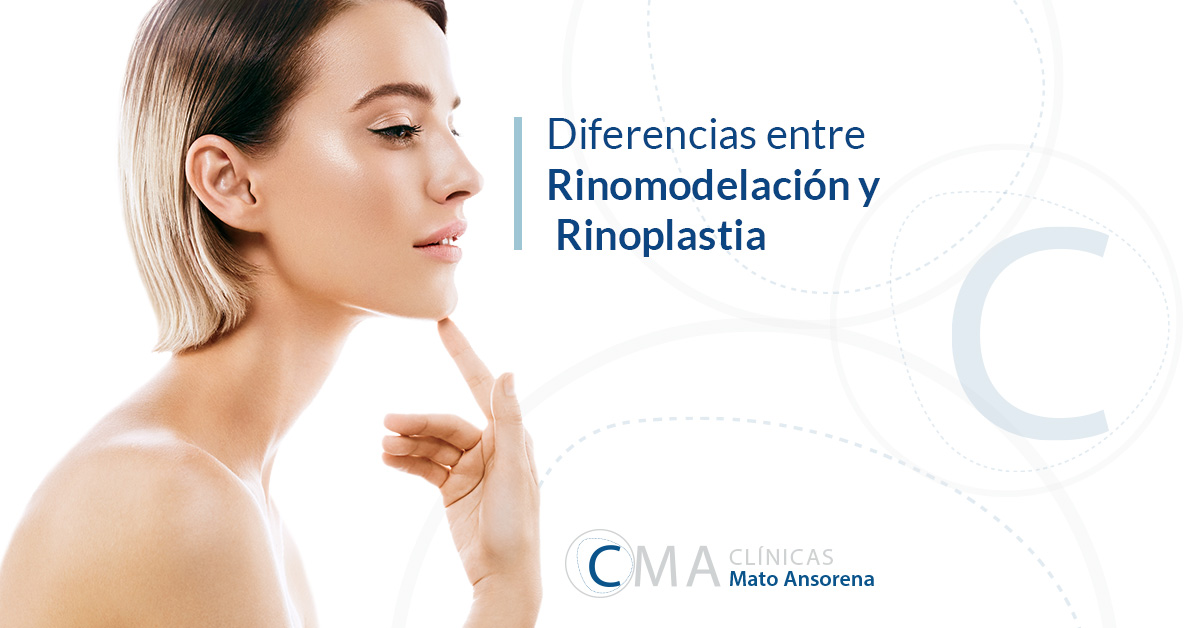 rinoplastia y rinomodelación