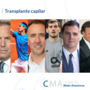 famosos trasplante capilar