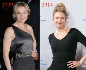 Renee-Zellweger-irreconocible-por-la-cirugia-estetica