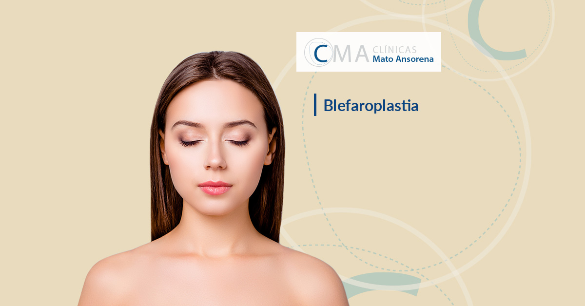 blefaroplastia