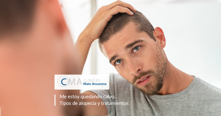 blog-calvicie-mato-ansorena alopecia