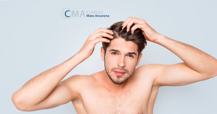 blog-mato-ansorena-alopecia tratamientos para la alopecia