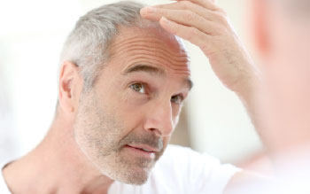 Carboxiterapia para la Alopecia