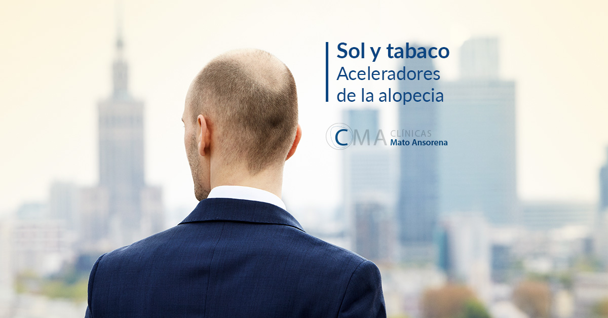 aceleradores de la alopecia