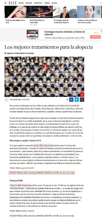 los-mejores-tratamientos-para-la-alopecia-telva