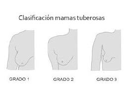 Mama tuberosa Mama tuberosa