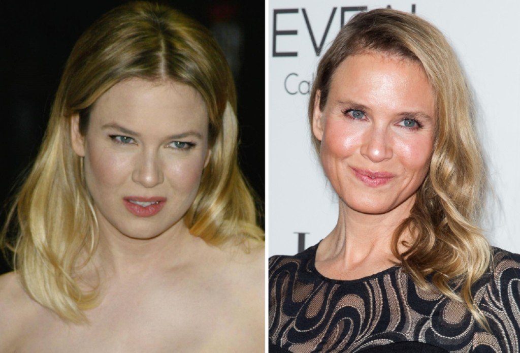 renee zellweger operaciones 