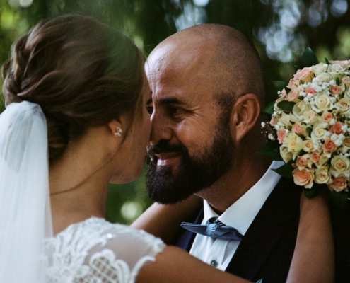 Novia y novio juntando sus rostros con tratamientos estéticos para el día de su boda